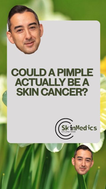 Dr. B is BACK after a whole month of MIA… we missed the memes, but more importantly—let's talk skin. Quick question: can pimples be skin cancer? If it doesn't heal or keeps changing, get it checked. 😅🩺✨ #SkinHealth #spotcheck #skincancer